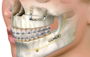 Maxillofacial Surgery