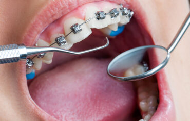 Orthodontics