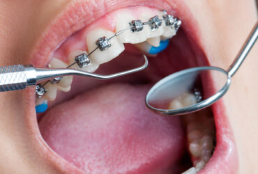 Orthodontics