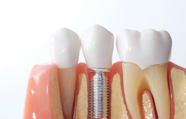 Implantology