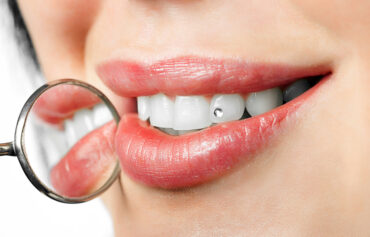 Tooth Jewellery