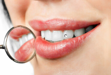 Tooth Jewellery
