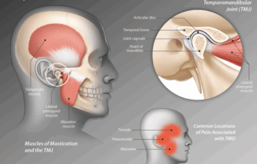 Jaw Joint Disorders / TMJ Disorders