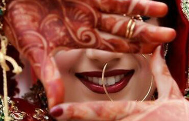 Wedding Dentistry
