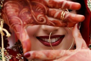 Wedding Dentistry